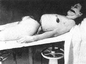 Autopsy table